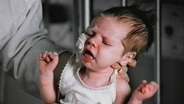 Whooping cough alert on Mid North Coast